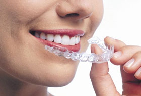 aligners and braces clinic porbandar