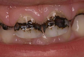 child dentistry porbandar