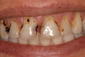 child dentistry in porbandar