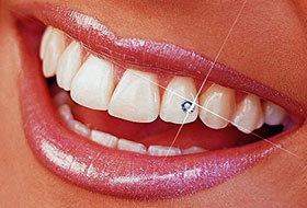 dental jewellery clinic in porbandar
