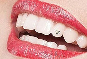 dental jewellery clinic in porbandar