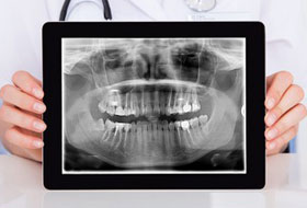 Digital X-ray in porbandar