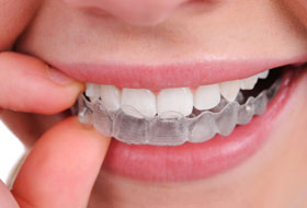 mouth guard in porbandar