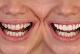 Smile Designing Clinic porbandar