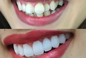 Smile Designing clinic at porbandar