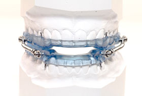 snoring therapy clinic in porbandar